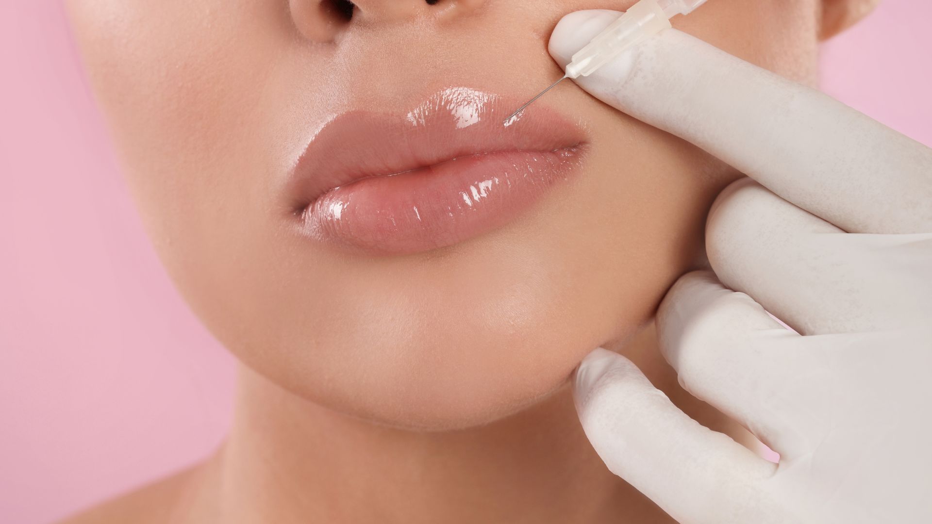 Lippenvergrößerung